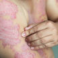 Some Types of Skin Infections That Can Take Away Your Career
