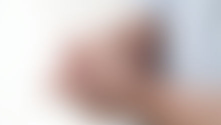 סבלתי מפגיעה ביד ימין שהפסיקה לתפקד - הסיפור המלא אורן זריף