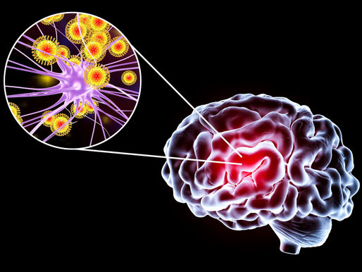 אנשים מספרים על הצלחה מדהימה בטיפול אורן זריף פסיכוקינזיס