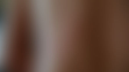 تعرف على أنواع الأمراض الجلدية-أورن زريف