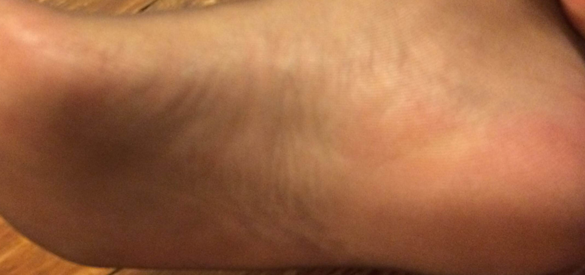 Black Toenails Man in/out Stockings