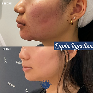 petit b&a -0320-1 4 (1).png