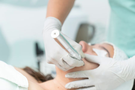 Mezoterapia mikroigłowa