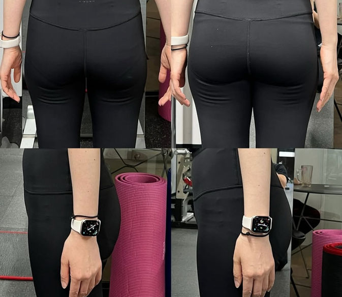 ヒップアップ before after
