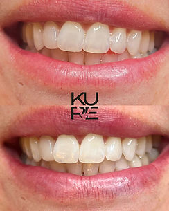 Teeth W.JPG