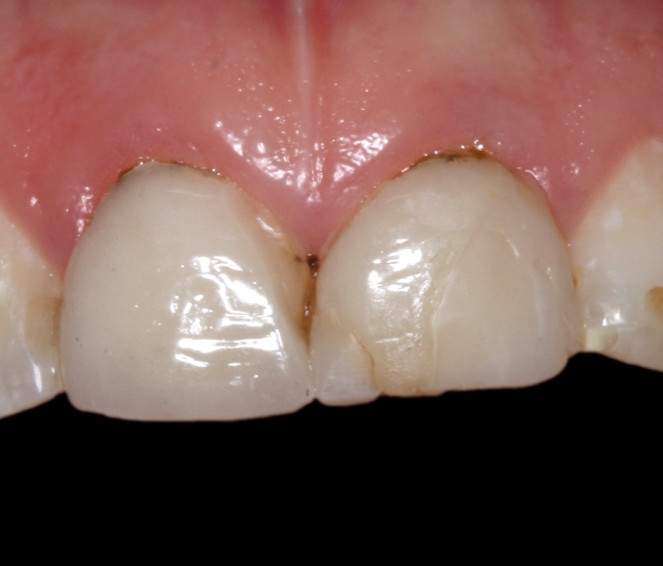 Crowns 1 Dan.jpg