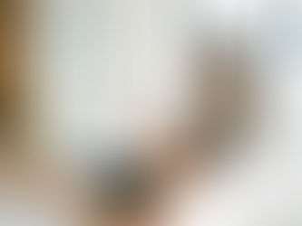 radiofrequence-visage-danger-2