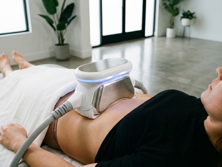 resultats-cryolipolyse-avant-apres-2