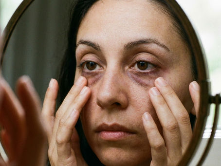 cernes-colores-traitement-2