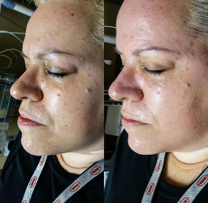 Skin Classic in Albuquerque, Rio Rancho, Los Lunas, Cedar Crest, Bernalillo, Santa Fe