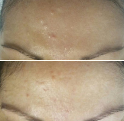 Skin Classic in Albuquerque, Rio Rancho, Los Lunas, Cedar Crest, Bernalillo, Santa Fe