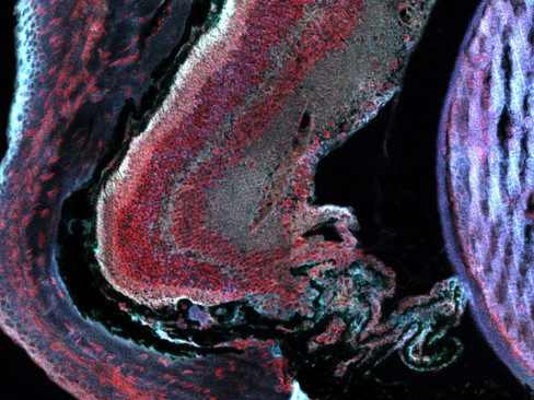 Eye 1 - Zoom 1