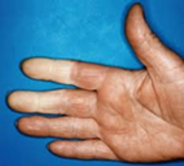 hand.png