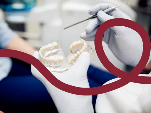 How do I take care of my Dental Implant after surgery?