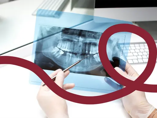 Can I get a Dental Implant if I’ve had missing teeth for years?