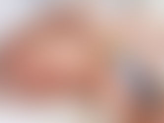 Tiêm Phòng Uốn Ván Cho Trẻ Khi Nào Thì Tốt Nhất?