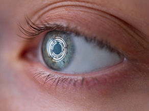 Qual o menor grau para poder fazer a cirurgia refrativa?