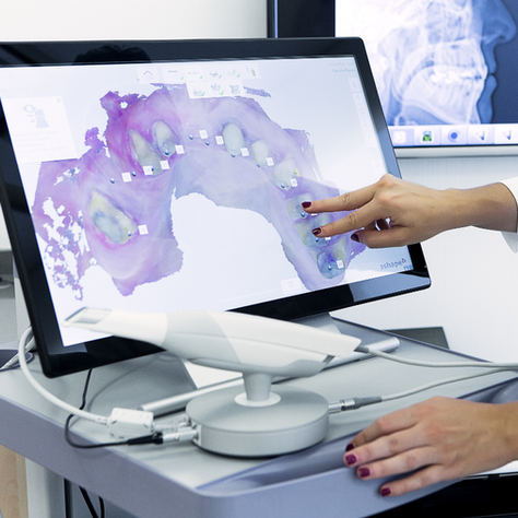 The Benefits of Digital Scanning for Dental Cases