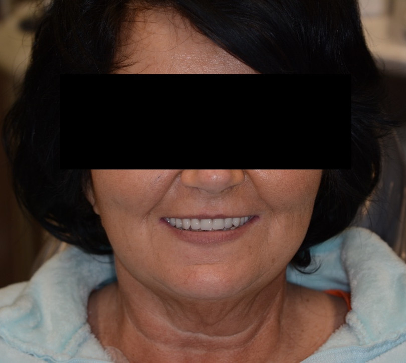 Academy Of Modern Implants And Dentistry King of Prussia