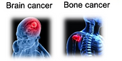 3D Disease Modeling