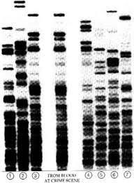 PolymErase the Evidence: Concerns in DNA profiling 