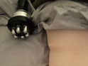 Breaking the Chains of Constricted Muscles: The Magic of Radio Frequency Therapy