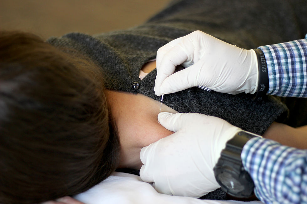Dry Needling