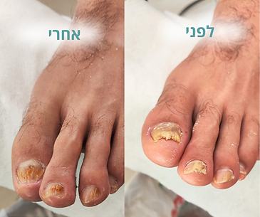 פדיקור לגברים