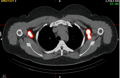 ct R01.png