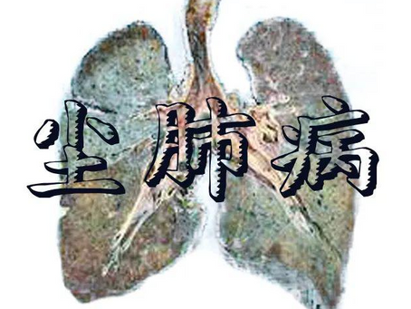 中医对尘肺病的辩证与治法