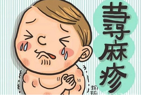 中医对荨麻疹的辩证与治法