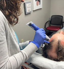 AnteAGE MD Hair Treatment