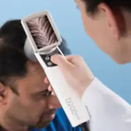 Weaver Clinics HairMetrix Procedure
