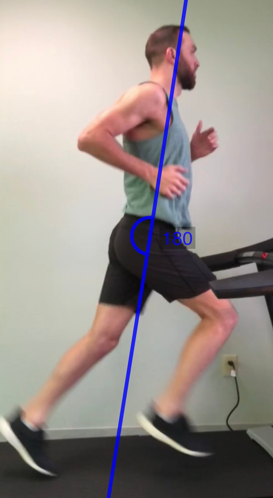 Forward Trunk Lean