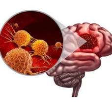 Beyond Rogue Cells: How Glioblastoma Recruits an Ecosystem to Survive