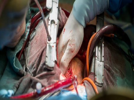 What Happens During Open Heart Surgery? Procedure, Risks, and Recovery