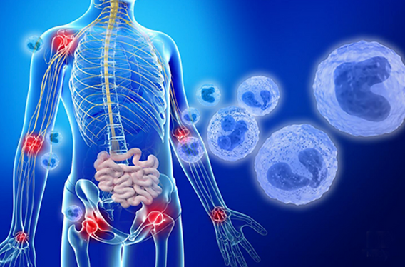 glp-1 and inflammation Glucagon-like peptide-1 receptor: mechanisms advances in therapy A surprising role for enteroendocrine