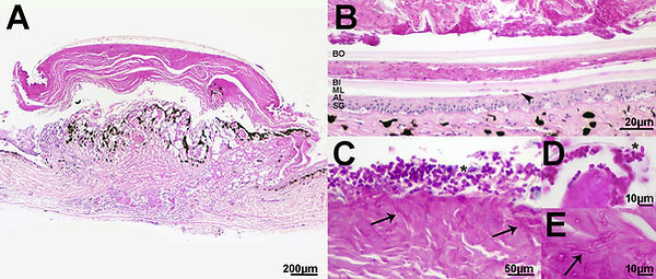 Histological photos of snake fungal disease
