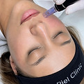 skin-rejuvenation-microneedling-whitby_edited.jpg