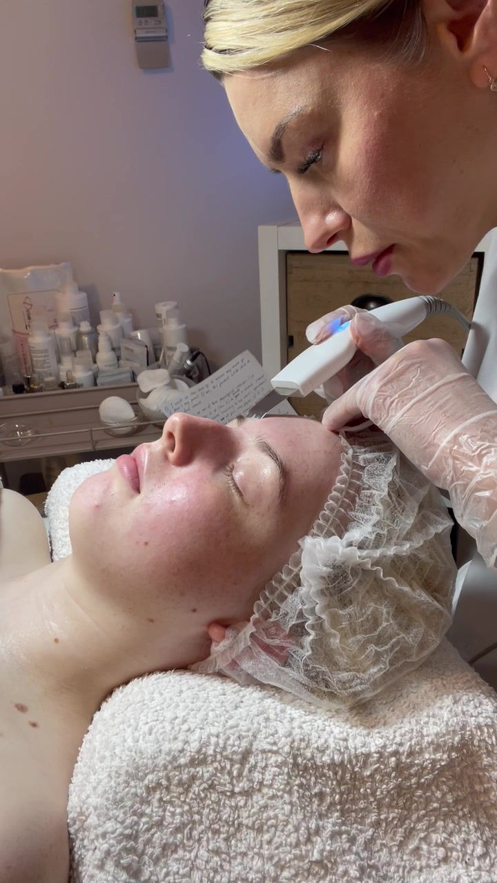 Thumbnail: NATINUEL NEUTRALIZE - peel neutraliser