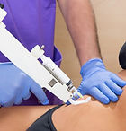 MESOTERAPIA.jpg