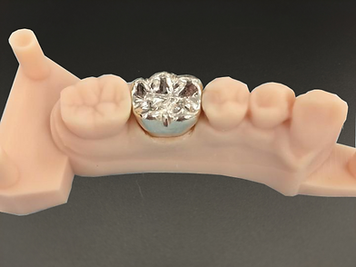 Full Cast Gold Crown Made in Millign Center