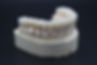 Milled Anterior Zirconia Bridge Pontic.j