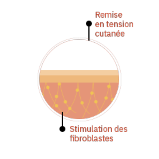 schéma du résultat