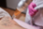 young-woman-undergoing-laser-tattoo-removal-procedure-salon-closeup.jpg