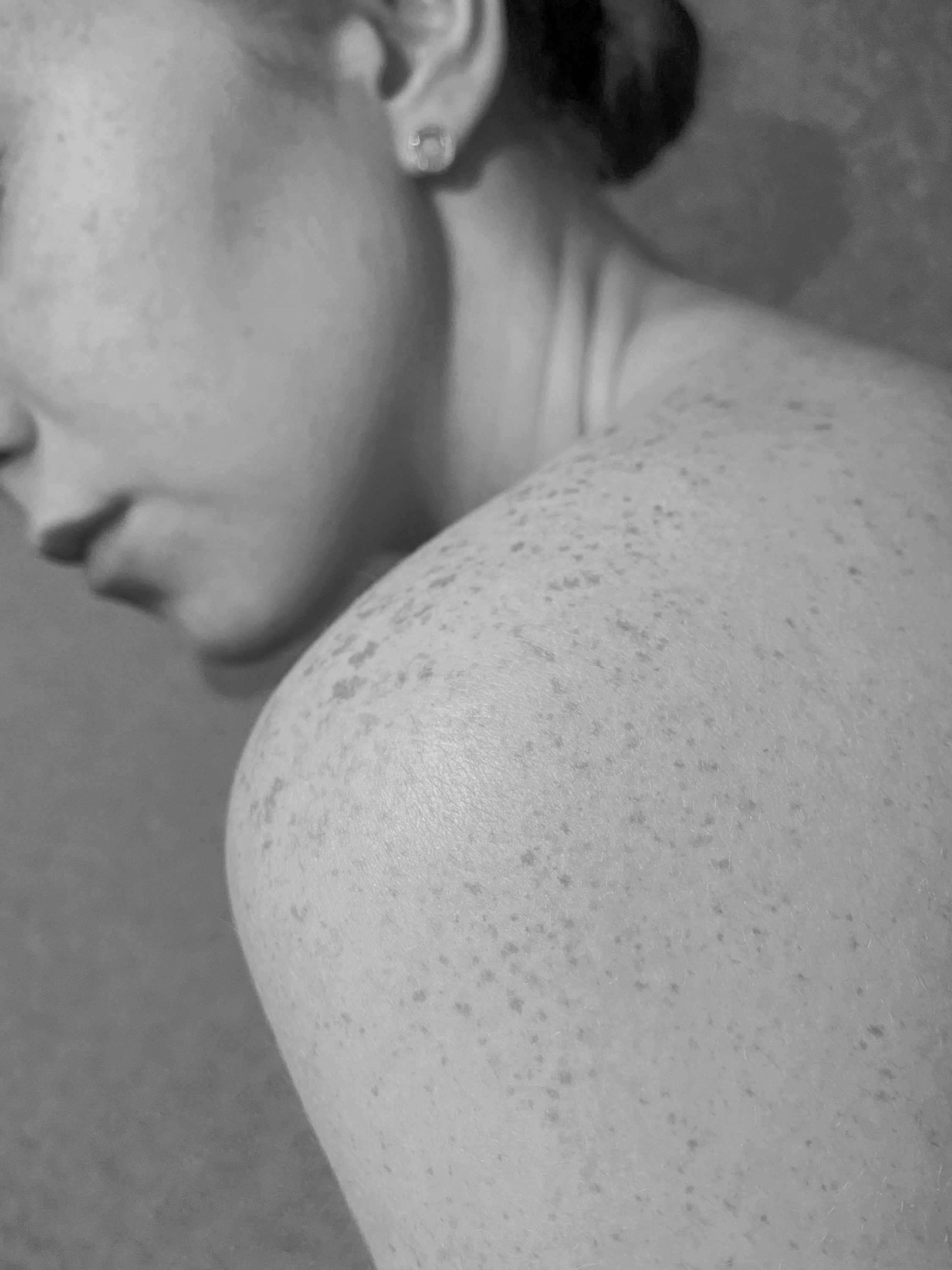 Paramedical Scar Revision