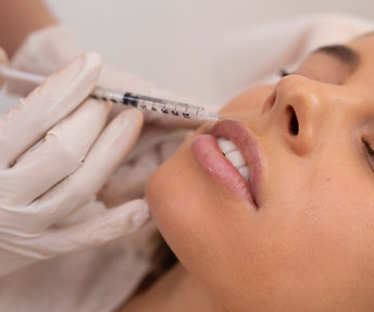 close-up-woman-getting-lip-filler-with-injection_edited.jpg