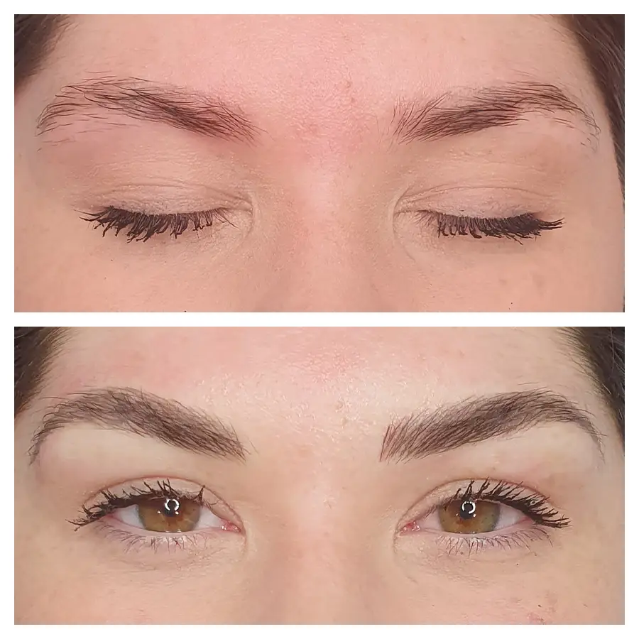 A before and after image of a woman who received a