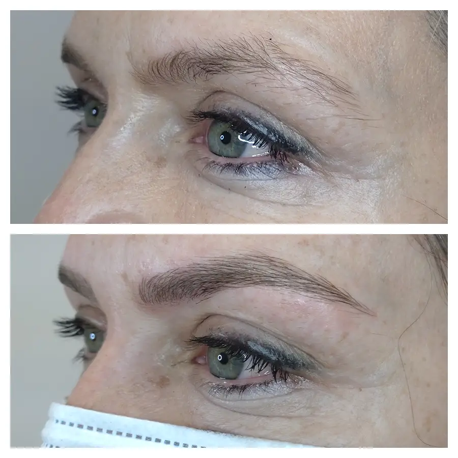 A before and after image of a woman who received a