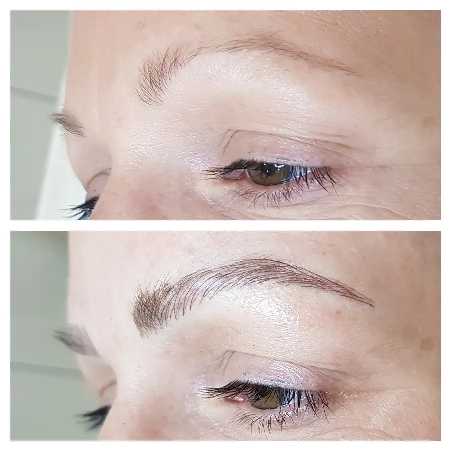 A before and after image of a woman who received a